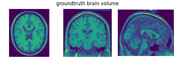 groundtruth brain volume