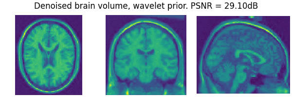 Denoised brain volume, wavelet prior. PSNR = 29.10dB