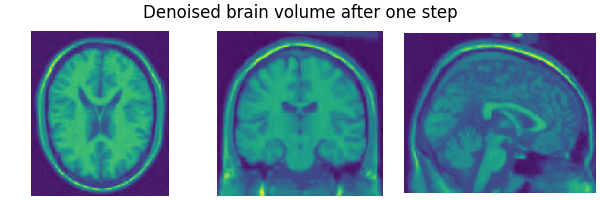 Denoised brain volume after one step