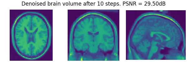 Denoised brain volume after 10 steps. PSNR = 29.50dB