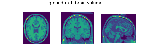 groundtruth brain volume