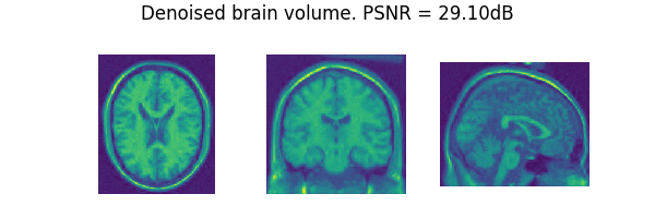 Denoised brain volume. PSNR = 29.10dB