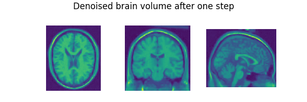 Denoised brain volume after one step