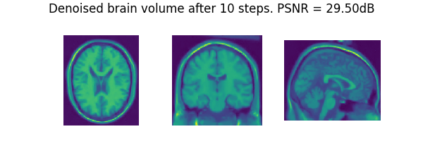 Denoised brain volume after 10 steps. PSNR = 29.50dB