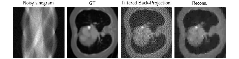 Noisy sinogram, GT, Filtered Back-Projection, Recons.