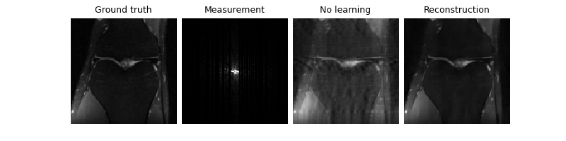 Ground truth, Measurement, No learning, Reconstruction