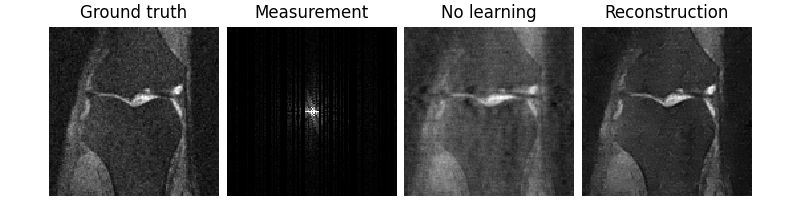 Ground truth, Measurement, No learning, Reconstruction