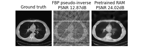 Ground truth, FBP pseudo-inverse  PSNR 12.87dB, Pretrained RAM  PSNR 24.02dB