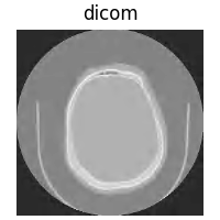 dicom