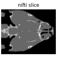 nifti slice
