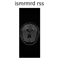 ismrmrd rss