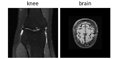 knee, brain