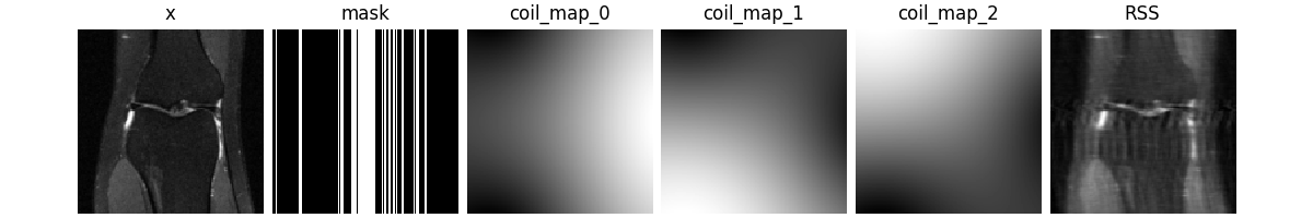 x, mask, coil_map_0, coil_map_1, coil_map_2, RSS
