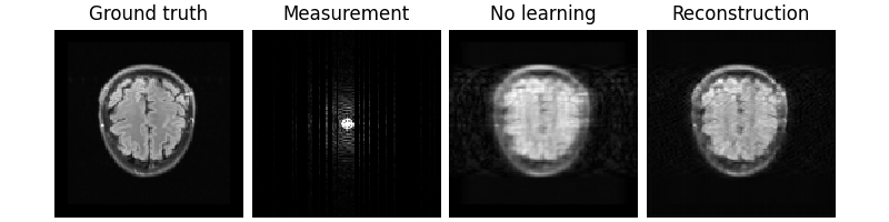 Ground truth, Measurement, No learning, Reconstruction