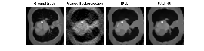 Ground truth, Filtered Backprojection, EPLL, PatchNR