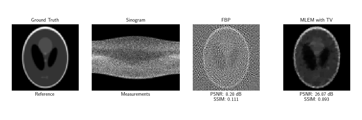 Ground Truth, Sinogram, FBP, MLEM with TV