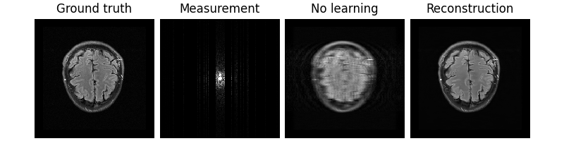 Ground truth, Measurement, No learning, Reconstruction