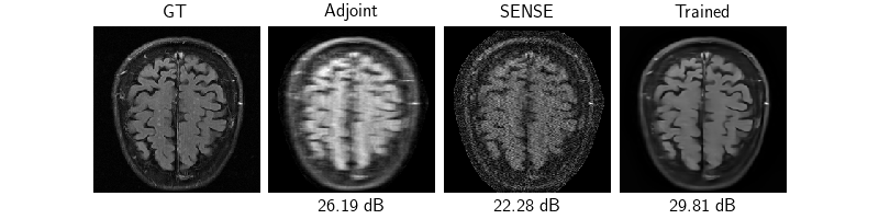 GT, Adjoint, SENSE, Trained