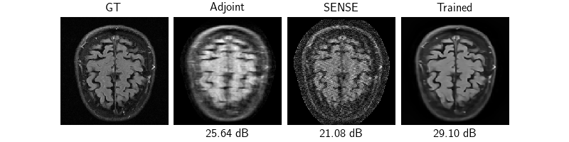 GT, Adjoint, SENSE, Trained