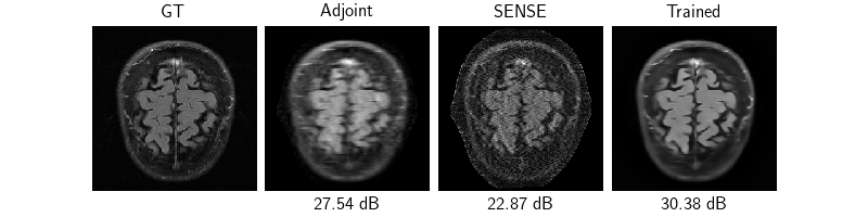 GT, Adjoint, SENSE, Trained