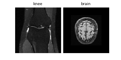 knee, brain