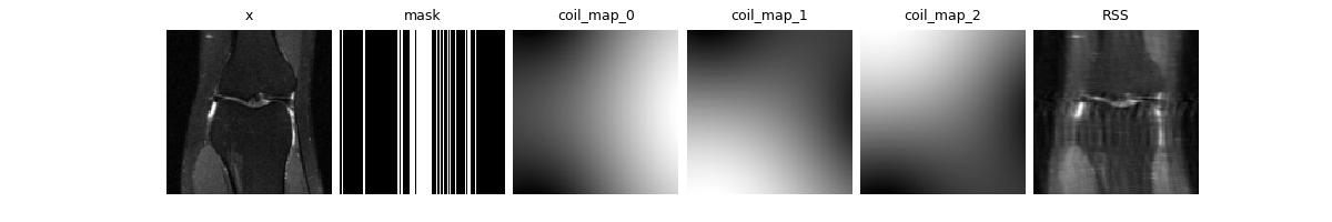 x, mask, coil_map_0, coil_map_1, coil_map_2, RSS