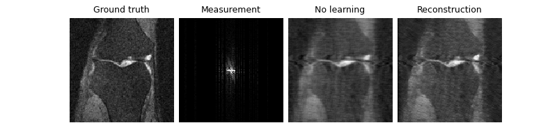 Ground truth, Measurement, No learning, Reconstruction