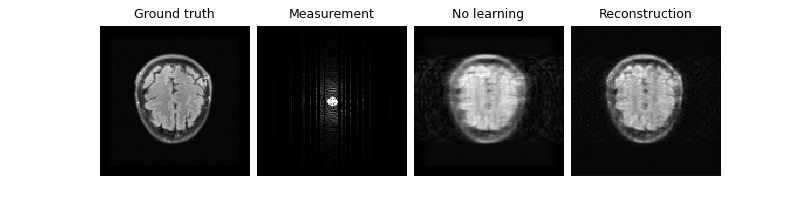 Ground truth, Measurement, No learning, Reconstruction